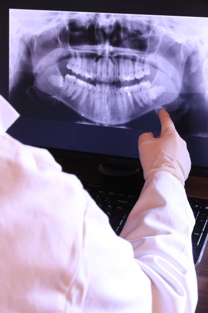 Best Emergency Dental Care for Broken or Chipped Teeth in South Williamsport, PA